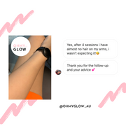 Ohmyglow IPL Hair Removal Handset