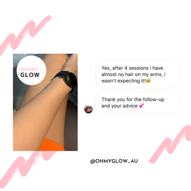 Ohmyglow IPL Hair Removal Handset